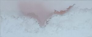 Pink vision